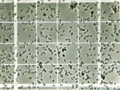 CATCH THE BUZZ – A Mobile Phone Microscope Is Good Enough To Find Nosema Spores In The Field.