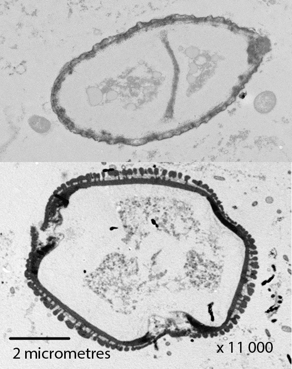 Figure 8. Sections through pollen grains from within the small intestine, after their contents have been digested while passing through the ventriculus.