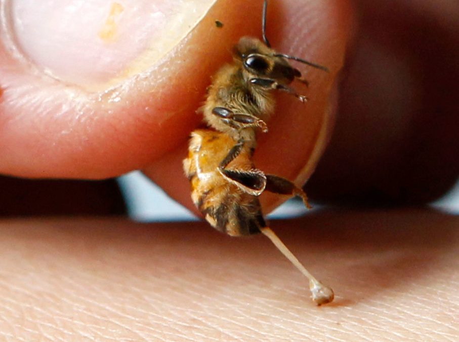 CATCH THE BUZZ – Australian Bee Sting Vaccine Trial Holds Promise Against Allergic Reactions.